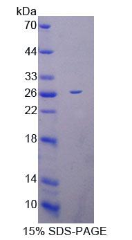 Recombinant Mitochondrial Ribosomal Protein L1 (MRPL1)
