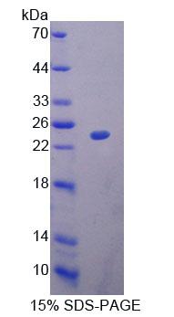 Recombinant Mitochondrial Ribosomal Protein L1 (MRPL1)