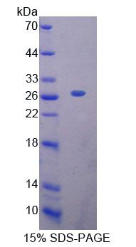 Recombinant Metal Regulatory Transcription Factor 1 (MTF1)