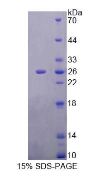 Recombinant Mitochondrial Tumor Suppressor 1 (MTUS1)