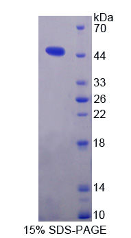 Recombinant Microsomal Triglyceride Transfer Protein (MTTP)