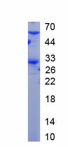 Recombinant Monoamine Oxidase B (MAOB)