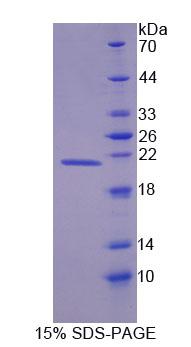 Recombinant Dystrophia Myotonica Protein Kinase (DMPK)