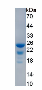 Recombinant Myocyte Specific Enhancer Factor 2A (MEF2A)