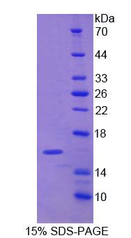 Recombinant Nuclear Prelamin A Recognition Factor (NARF)