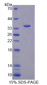 Recombinant Neurochondrin (NCDN)