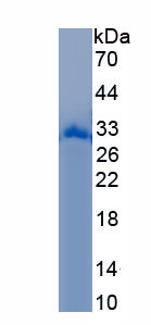 Recombinant N-Myristoyltransferase 2 (NMT2)