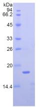 Recombinant Nucleophosmin 1 (NPM1)