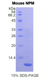 Recombinant Nucleophosmin 1 (NPM1)