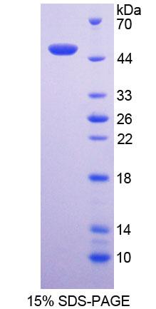Recombinant Neutrophil Cytosolic Factor 1 (NCF1)
