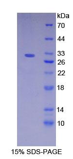 Recombinant Nicastrin (NCSTN)