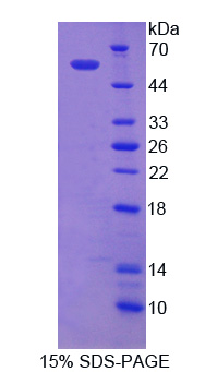 Recombinant Nicastrin (NCSTN)