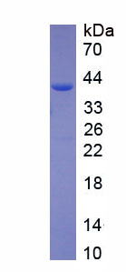 Recombinant 2',5'-Oligoadenylate Synthetase 1 (OAS1)