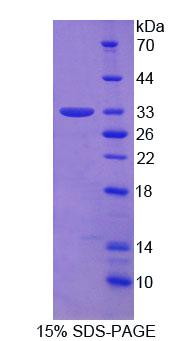 Recombinant 2',5'-Oligoadenylate Synthetase 1 (OAS1)