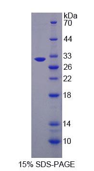 Recombinant Osteosarcoma Amplified 9 (OS9)