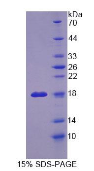 Recombinant Osteopetrosis Associated Transmembrane Protein 1 (OSTM1)