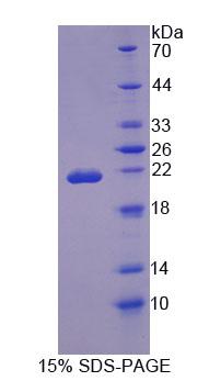 Recombinant Osteopetrosis Associated Transmembrane Protein 1 (OSTM1)