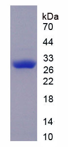 Recombinant Pyruvate Dehydrogenase Kinase Isozyme 1 (PDK1)