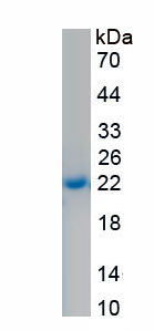 Recombinant Podoplanin (PDPN)