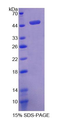 Recombinant Podoplanin (PDPN)