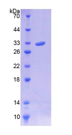 Recombinant Twinkle Protein, Mitochondrial (TWINL)