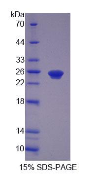 Recombinant Peroxisomal Biogenesis Factor 1 (PEX1)