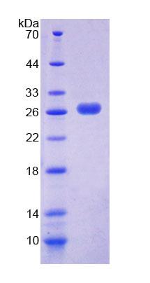 Recombinant Peroxisomal Biogenesis Factor 1 (PEX1)