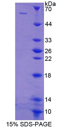 Recombinant Polypyrimidine Tract Binding Protein 1 (PTBP1)