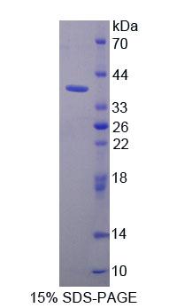 Recombinant Purine Rich Element Binding Protein A (PURA)