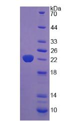 Recombinant Parathyroid Hormone Receptor 1 (PTHR1)