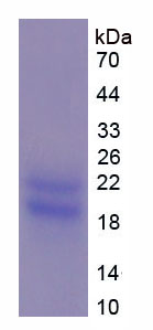 Recombinant Peripheral Myelin Protein 22 (PMP22)