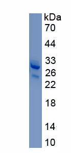 Recombinant Heparan Sulfate Proteoglycan 2 (HSPG2)