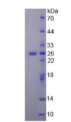 Recombinant Phenylalanine Hydroxylase (PAH)