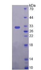 Recombinant Plectin (PLEC)