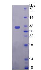 Recombinant Plectin (PLEC)