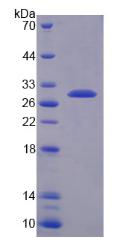 Recombinant Quinoid Dihydropteridine Reductase (QDPR)