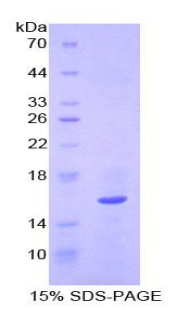 Recombinant Quiescin Q6 Sulfhydryl Oxidase 1 (QSOX1)