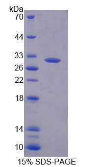 Recombinant Quiescin Q6 Sulfhydryl Oxidase 1 (QSOX1)