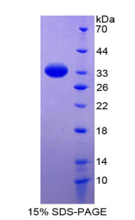 Recombinant Renin Binding Protein (RENBP)