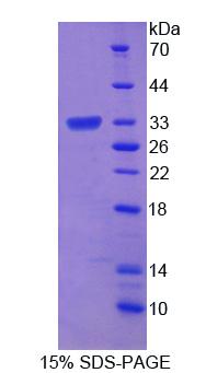 Recombinant Retinal Outer Segment Membrane Protein 1 (ROM1)