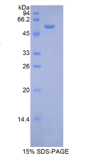 Recombinant Ribophorin I (RPN1)
