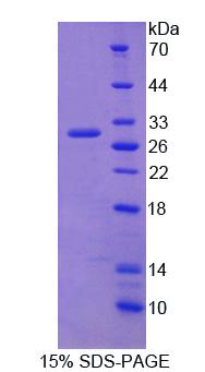 Recombinant Ribosome Binding Protein 1 (RRBP1)