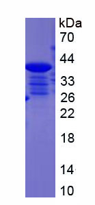 Recombinant Rhotekin (RTKN)