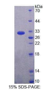 Recombinant Rhotekin (RTKN)