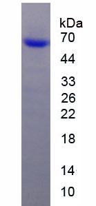 Recombinant Ryanodine Receptor 1, Skeletal (RYR1)