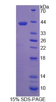 Recombinant Retinaldehyde Binding Protein 1 (RLBP1)