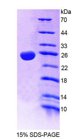 Recombinant Threonine Aspartase 1 (TASP1)