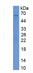 Recombinant Tyrosyl DNA Phosphodiesterase 1 (TDP1)