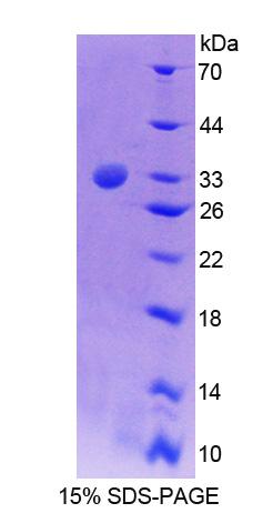 Recombinant Tec Protein Tyrosine Kinase (TEC)