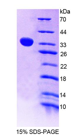 Recombinant Thymocyte Nuclear Protein 1 (THYN1)